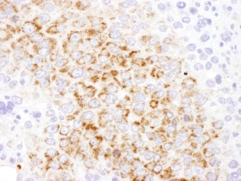 Rabbit GOT2 Antibody