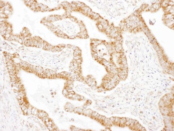 Rabbit GOT2 Antibody