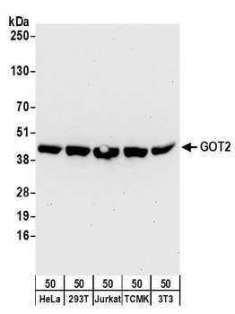 Rabbit GOT2 Antibody