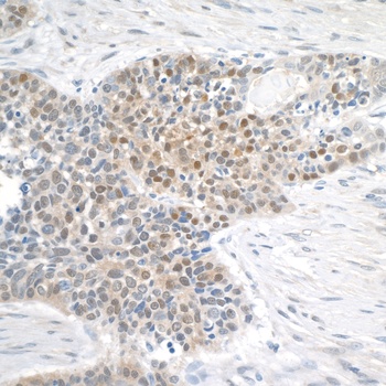 Rabbit MGEA5 Antibody