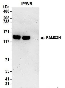 Rabbit FAM83H Antibody