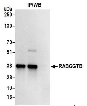 Rabbit RABGGTB Antibody