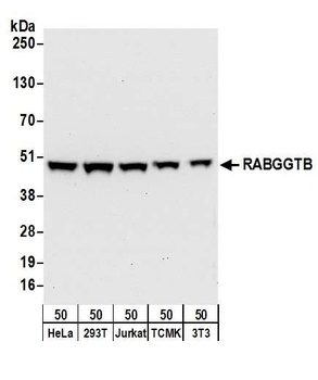 Rabbit RABGGTB Antibody
