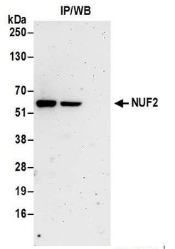 Rabbit NUF2 Antibody