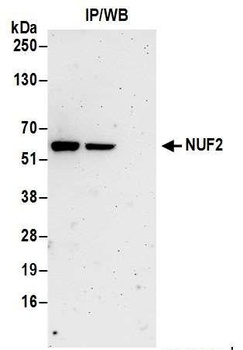 Rabbit NUF2 Antibody