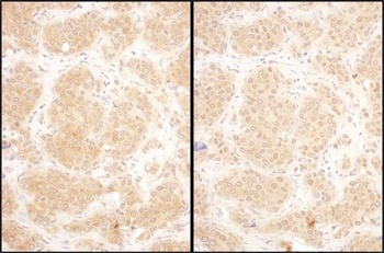 Rabbit GART Antibody