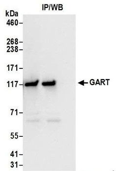 Rabbit GART Antibody