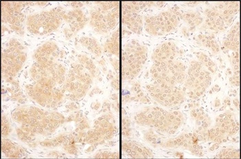 Rabbit GART Antibody