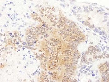 Rabbit GART Antibody