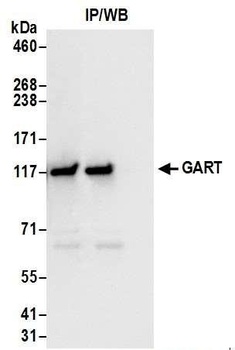 Rabbit GART Antibody