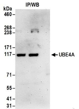 Rabbit UBE4A Antibody