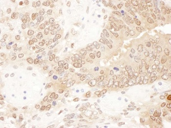 Rabbit ACAT2 Antibody