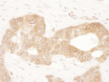 Rabbit ACAT2 Antibody