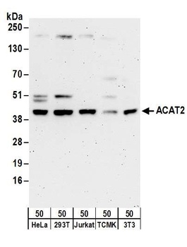 Rabbit ACAT2 Antibody