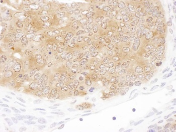 Rabbit SHMT1 Antibody