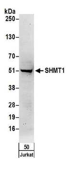 Rabbit SHMT1 Antibody