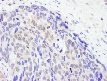 Rabbit TET2 Antibody