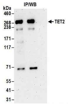 Rabbit TET2 Antibody
