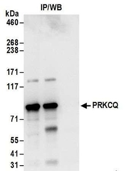 Rabbit PRKCQ Antibody