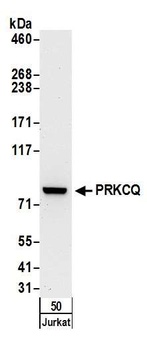 Rabbit PRKCQ Antibody