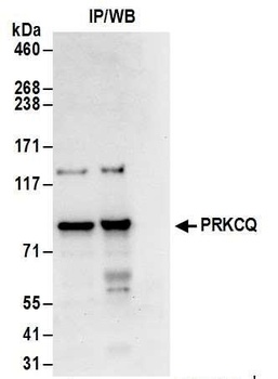 Rabbit PRKCQ Antibody