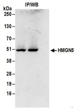 Rabbit HMGN5 Antibody