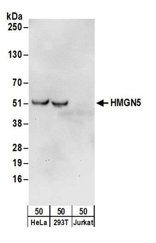 Rabbit HMGN5 Antibody