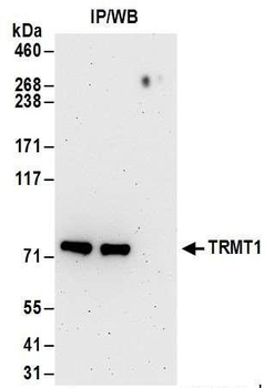 Rabbit TRMT1 Antibody