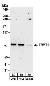Rabbit TRMT1 Antibody