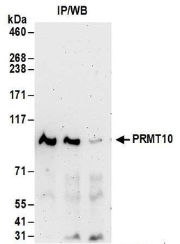 Rabbit PRMT10 Antibody