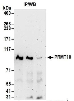 Rabbit PRMT10 Antibody