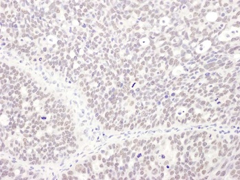 Rabbit MEPCE Antibody