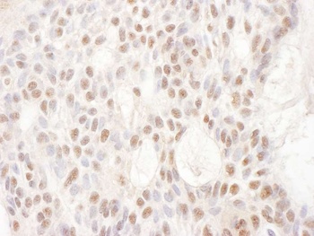 Rabbit CDKL5 Antibody
