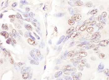 Rabbit CDKL5 Antibody