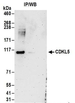 Rabbit CDKL5 Antibody