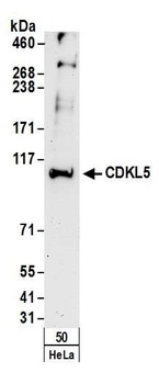 Rabbit CDKL5 Antibody