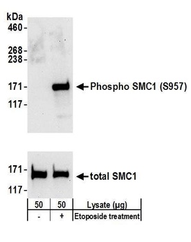 Rabbit Phospho SMC1 (S957) Antibody