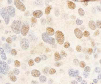 Rabbit c-Myb Antibody