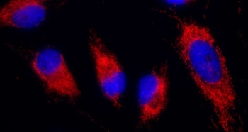 Rabbit IDH2 Antibody