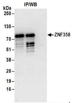 Rabbit ZNF358 Antibody