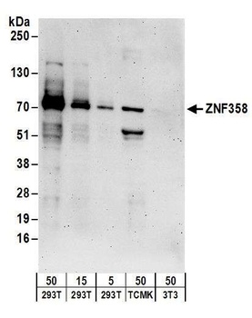 Rabbit ZNF358 Antibody