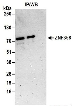 Rabbit ZNF358 Antibody