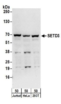 Rabbit anti-SETD3 Antibody