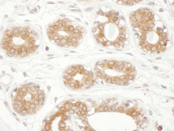 Rabbit TMX1 Antibody