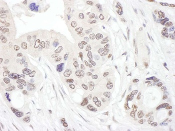 Rabbit NHP2L1 Antibody