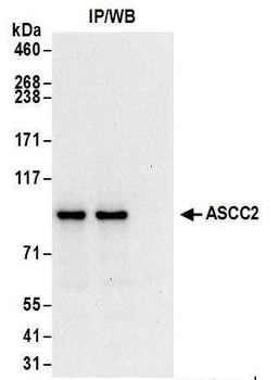 Rabbit ASCC2 Antibody