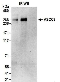 Rabbit ASCC3 Antibody