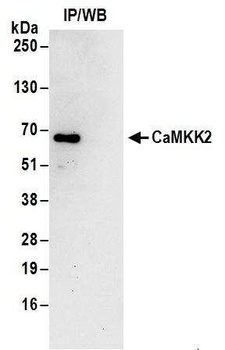 Rabbit CaMKK2 Antibody
