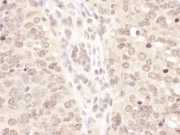 Rabbit TCEB2 Antibody