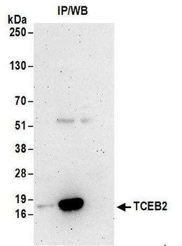 Rabbit TCEB2 Antibody